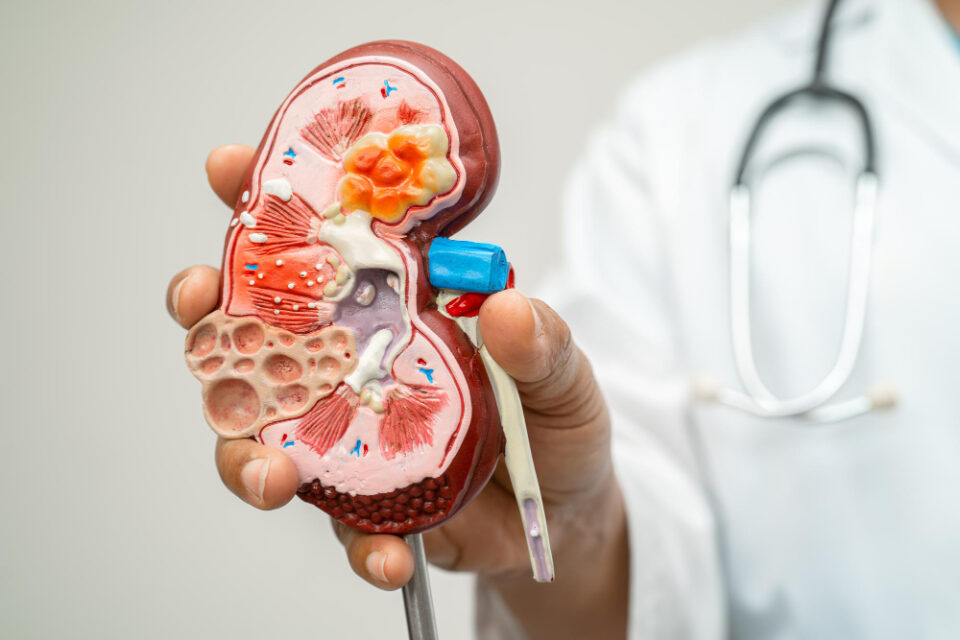 chronic kidney disease